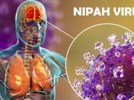 Kerala Government Takes Firm Actions Against Nipah Virus Outbreak; Specialists Share Safety Recommendations. Nipah Virus Outbreak in Kerala