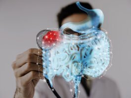 Colorectal Cancer: Understanding Key Signs for Early Detection colorectal cancer signs