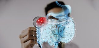 Colorectal Cancer: Understanding Key Signs for Early Detection colorectal cancer signs