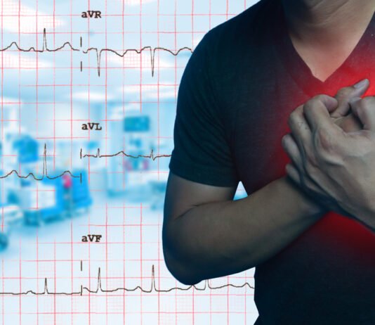 Heart Attack Symptoms: How to Assist Someone in Need heart attack